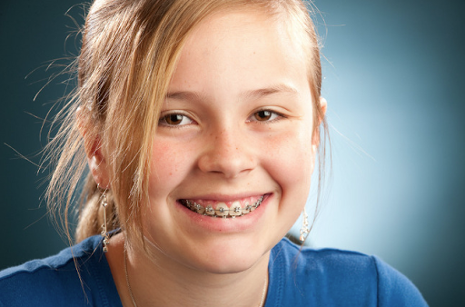 cost of braces girl with braces smiling