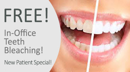 Free In-Office Teeth Bleaching Coupongit